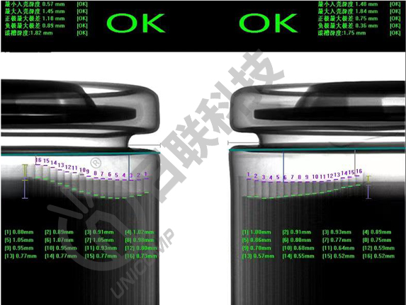 X-ray设备 X-ray设备